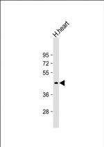 PDK4 Antibody in Western Blot (WB)