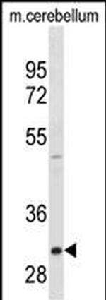 ZWINT Antibody in Western Blot (WB)