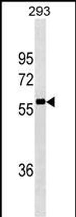 NCOA4 Antibody in Western Blot (WB)