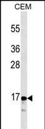 Calcitonin Antibody in Western Blot (WB)