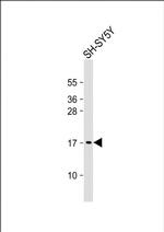 GABARAP Antibody in Western Blot (WB)