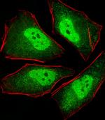 PSMA5 Antibody in Immunocytochemistry (ICC/IF)