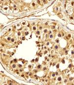 PSMA5 Antibody in Immunohistochemistry (Paraffin) (IHC (P))