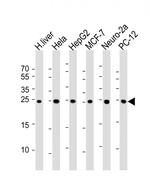 PSMA5 Antibody in Western Blot (WB)