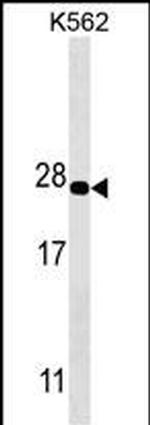 PSMA5 Antibody in Western Blot (WB)