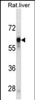 SERPINC1 Antibody in Western Blot (WB)