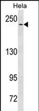 NOTCH3 Antibody in Western Blot (WB)