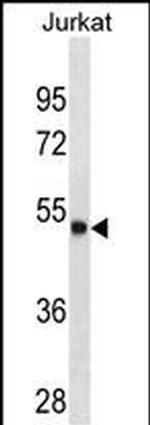 Arylsulfatase A Antibody in Western Blot (WB)