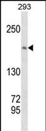 TOP2A Antibody in Western Blot (WB)