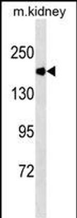 ACE Antibody in Western Blot (WB)