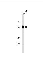 Catalase Antibody in Western Blot (WB)