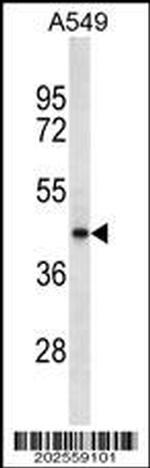 Tecrl Antibody in Western Blot (WB)