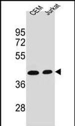 Adenosine Deaminase Antibody in Western Blot (WB)