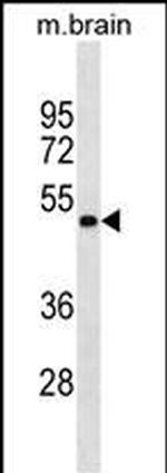 GNAS Antibody in Western Blot (WB)