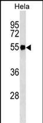 Fibrinogen gamma Antibody in Western Blot (WB)