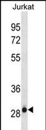 HAGH Antibody in Western Blot (WB)