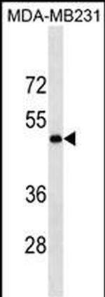 LOX Antibody in Western Blot (WB)