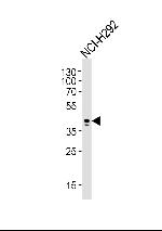 AIM2 Antibody in Western Blot (WB)