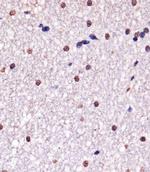 YY1 Antibody in Immunohistochemistry (Paraffin) (IHC (P))