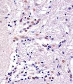 YY1 Antibody in Immunohistochemistry (Paraffin) (IHC (P))