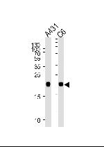 N-Ras Antibody in Western Blot (WB)