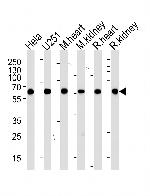 BBS4 Antibody in Western Blot (WB)