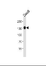 USP25 Antibody in Western Blot (WB)