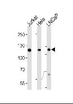 USP11 Antibody in Western Blot (WB)