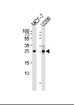 p27 Kip1 Antibody in Western Blot (WB)