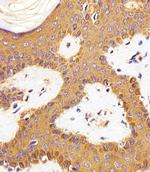 RAC1 Antibody in Immunohistochemistry (Paraffin) (IHC (P))