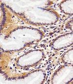 RAC1 Antibody in Immunohistochemistry (Paraffin) (IHC (P))