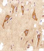 VAMP8 Antibody in Immunohistochemistry (Paraffin) (IHC (P))