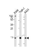 VAMP8 Antibody in Western Blot (WB)