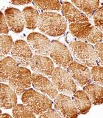 Raptor Antibody in Immunohistochemistry (Paraffin) (IHC (P))