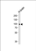 TrkB Antibody in Western Blot (WB)