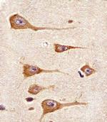 MCK10 Antibody in Immunohistochemistry (Paraffin) (IHC (P))