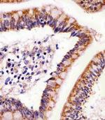 Abl2 Antibody in Immunohistochemistry (Paraffin) (IHC (P))