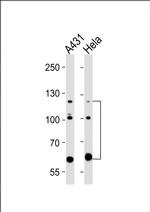 Abl2 Antibody in Western Blot (WB)