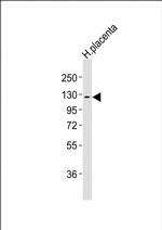 CSF1R Antibody in Western Blot (WB)