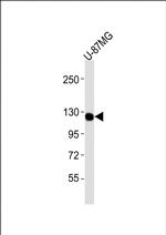 CSF1R Antibody in Western Blot (WB)