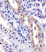 XIAP Antibody in Immunohistochemistry (Paraffin) (IHC (P))