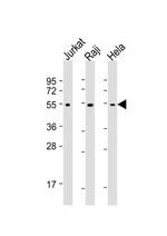 XIAP Antibody in Western Blot (WB)