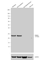 RAB3a Antibody in Western Blot (WB)