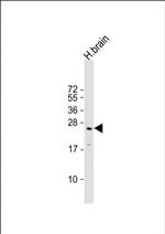 RAB3a Antibody in Western Blot (WB)