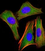 IRF3 Antibody in Immunocytochemistry (ICC/IF)