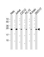 RAB11A Antibody in Western Blot (WB)