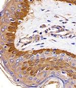 S100A2 Antibody in Immunohistochemistry (Paraffin) (IHC (P))