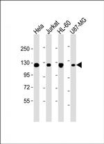 RNF20 Antibody in Western Blot (WB)