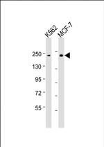 XRN1 Antibody in Western Blot (WB)