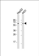 RAP1 Antibody in Western Blot (WB)